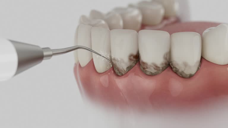 Trusted Teeth Cleaning And Checkup service in Rosedale, MS - Dentist Open Now